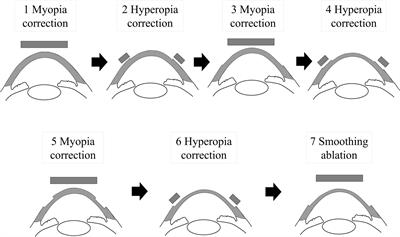 Hyperopia-Correcting Phototherapeutic Keratectomy and Its Comparison With Conventional Phototherapeutic Keratectomy